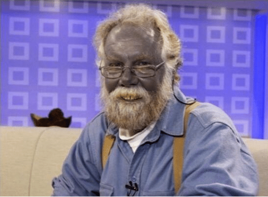 世界上有一种人,不光皮肤还有血液都是蓝色,你见过吗? 88必发官网登入