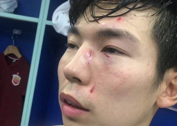 「永利在线棋牌平台」中超头号恶人!暴力飞踹后附加动作用心险恶,被踹者险失明