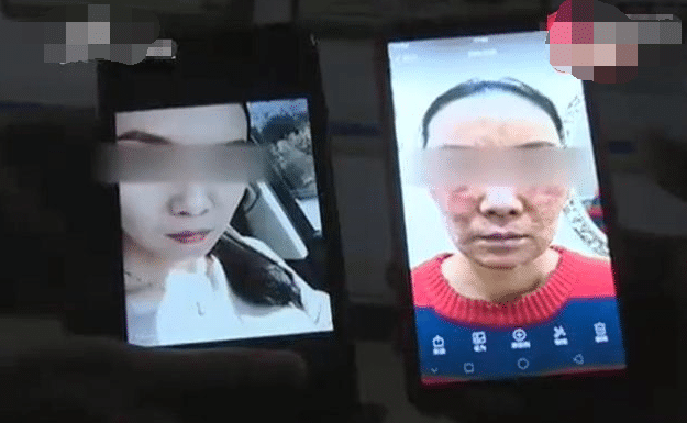 女子用美容院护肤品,一个月变“蛤蟆皮”脸,卖家:还在排毒呢 龙8国际手机登录