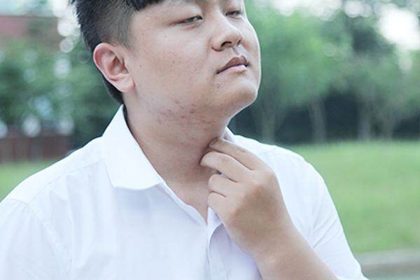 脖子和腋下的“小肉粒”是什么？能直接用手揪掉吗？看完要记牢
