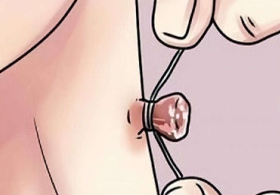 脖子和腋下的“小肉粒”是什么？能直接用手揪掉吗？看完要记牢