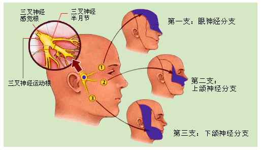 世上最疼的病是什么病？临床上这4种“疼痛”，经历过的都是超人