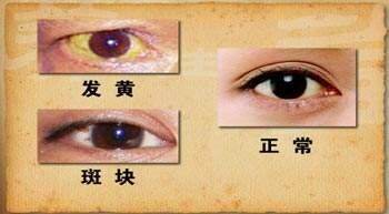 肝发硬，头先知？头部若出现这几种情况，或要引起重视