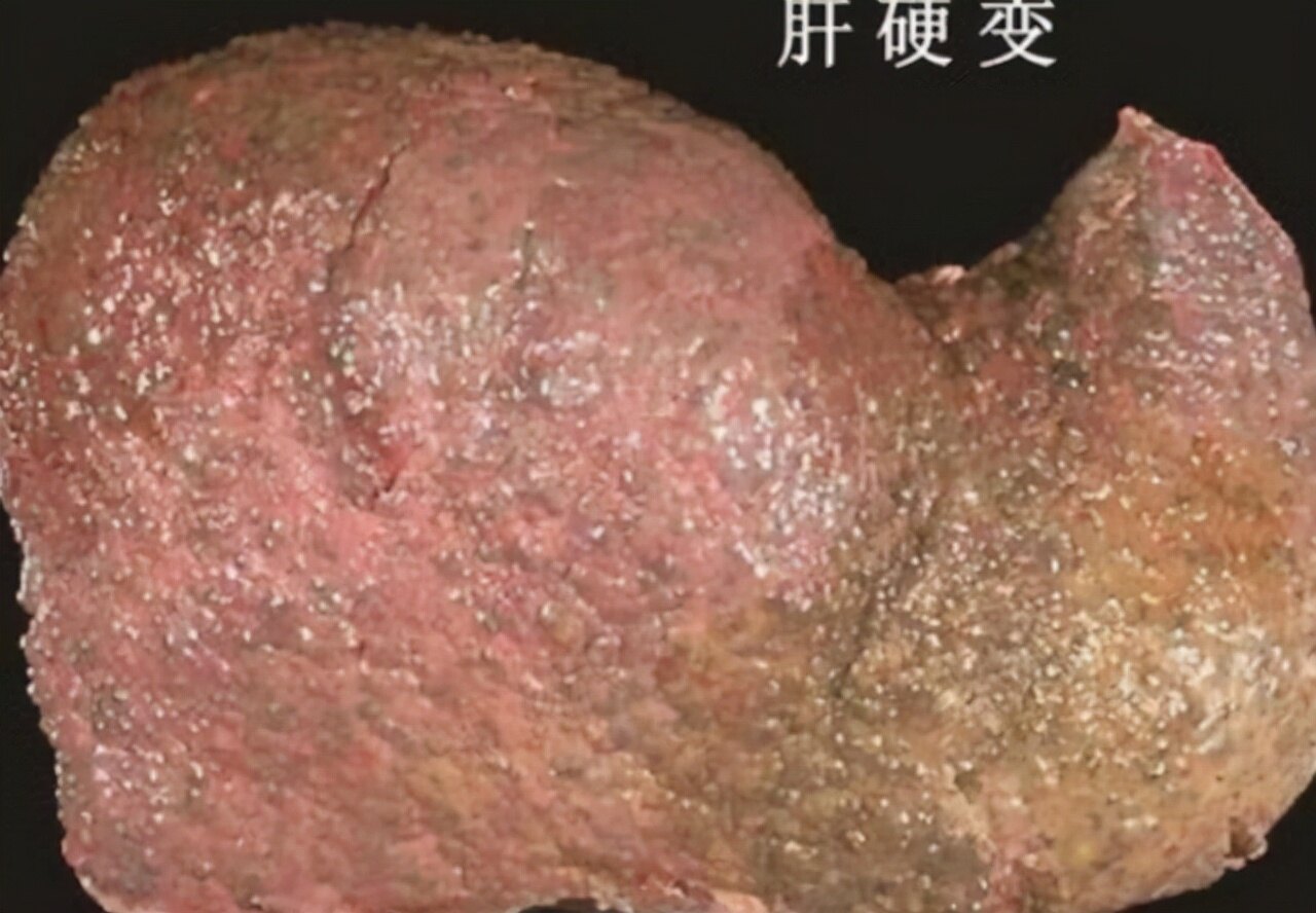 肝发硬，头先知？头部若出现这几种情况，或要引起重视