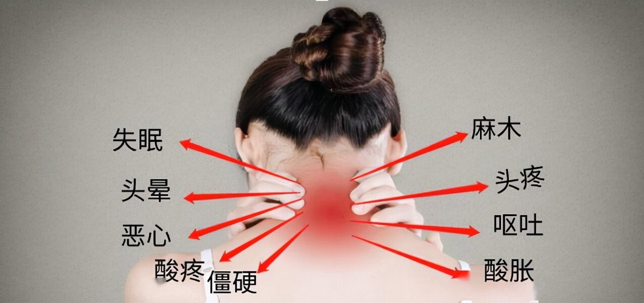 经常头晕，到底是不是因为颈椎病？教您在家1分钟自测，建议收藏