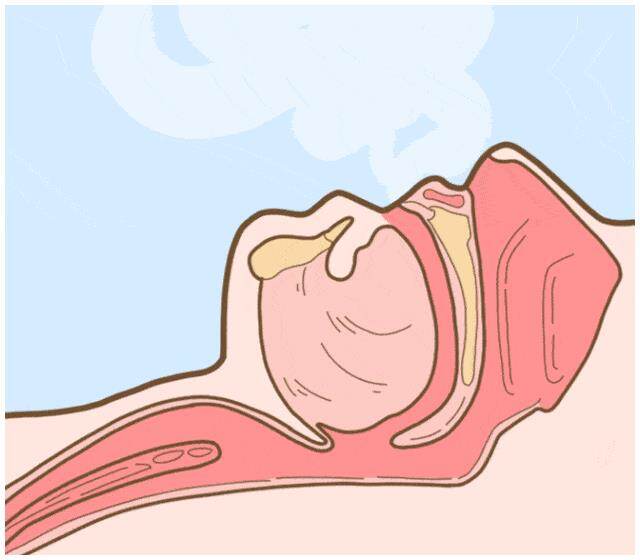 2.gif
