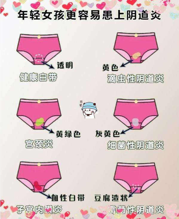 内裤是女性健康的“提示板”？若出现3种情况，建议尽早做检查