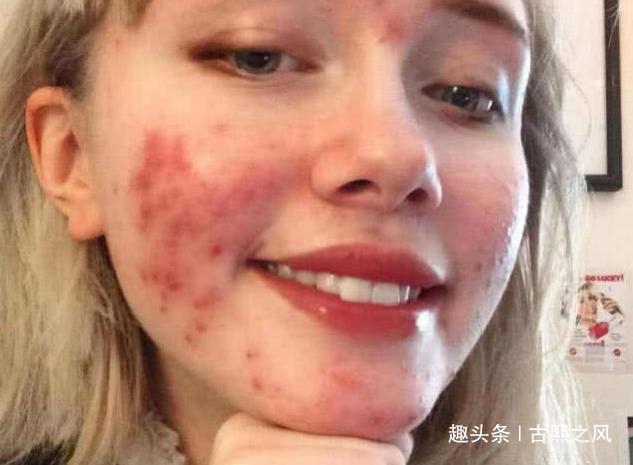 子宫"脏兮兮"的女孩,脸部有这"3特征",00后女生也要了解!